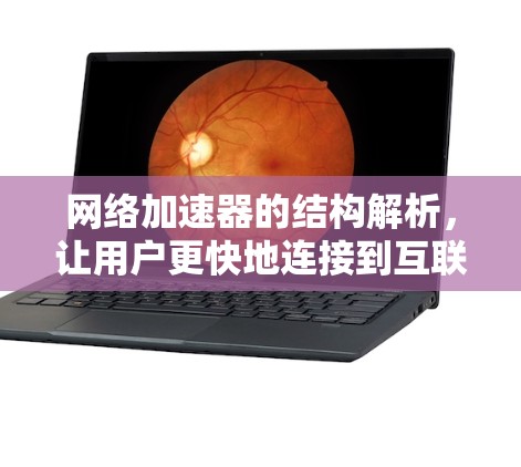 网络加速器的结构解析，让用户更快地连接到互联网
